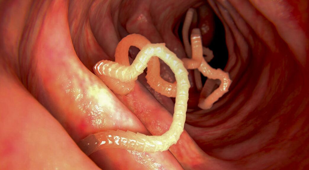diagnosis of parasites in the intestine