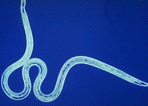 heartworm from the human body