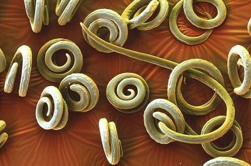 Priquinella human parasites