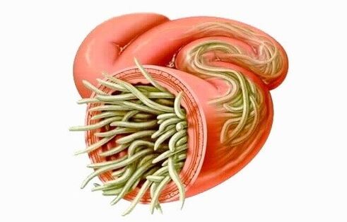 Worms are parasites of the human intestine