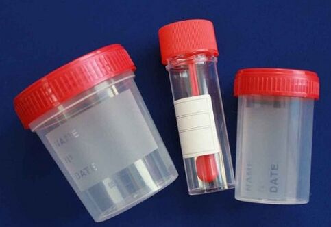 jars for parasite testing